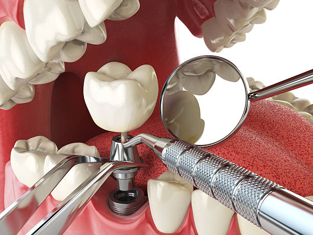 Best Walk-In Emergency Dentist in Desoto, TX